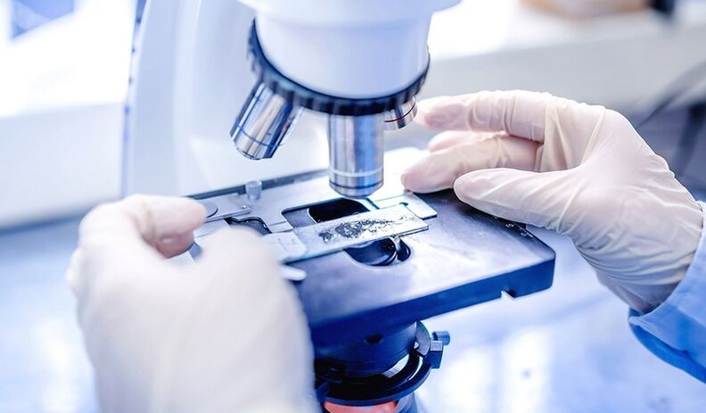 azazkalen onddoaren laborategiko diagnostikoa