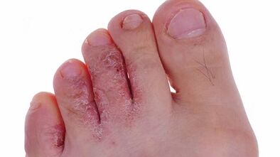 Hanketan onddoen garapen motak eta faseak