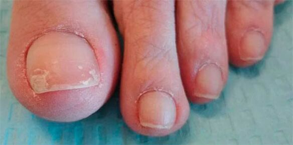 Onddoen hanken faseak