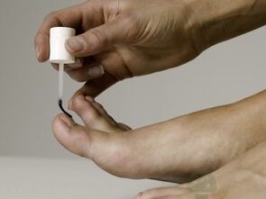 Iltze onddoaren tratamendua