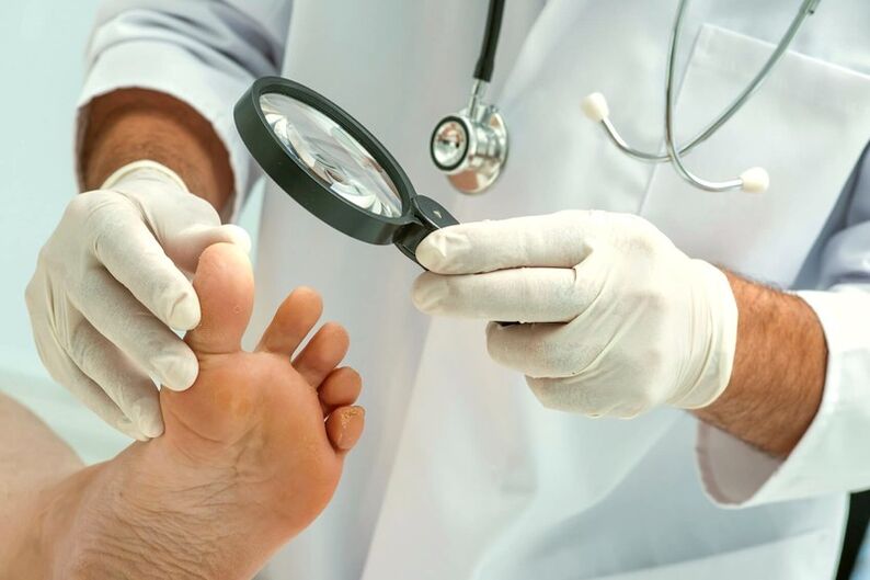 oinetako azazkalak aztertzen dituen dermatologoa