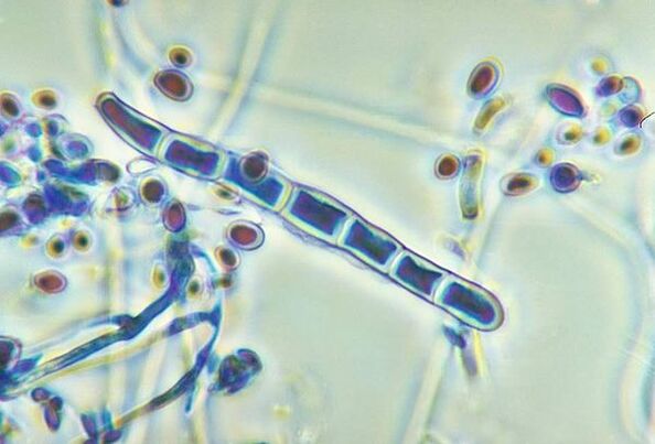 Trichophyton rubrum onddoa mikroskopiopean