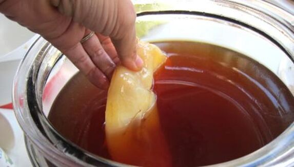 Kombucha iltze onddoak tratatzeko
