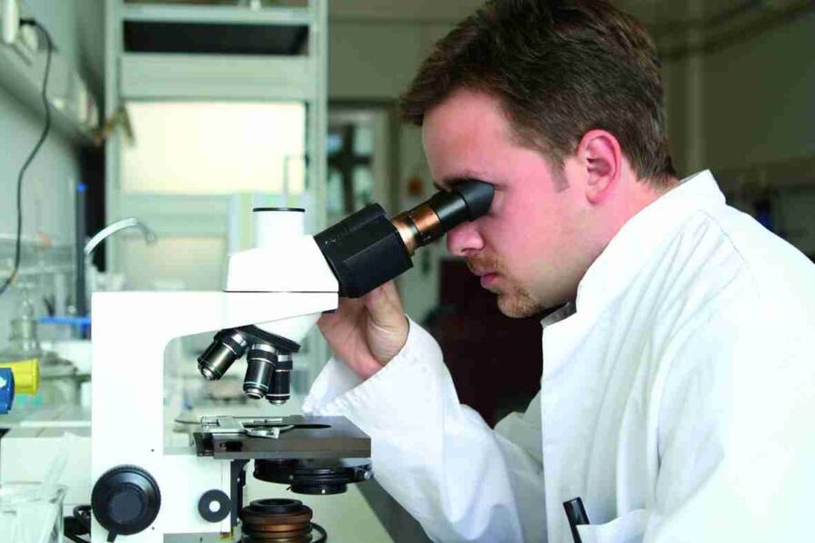 azazkalen onddoaren laborategiko diagnostikoa
