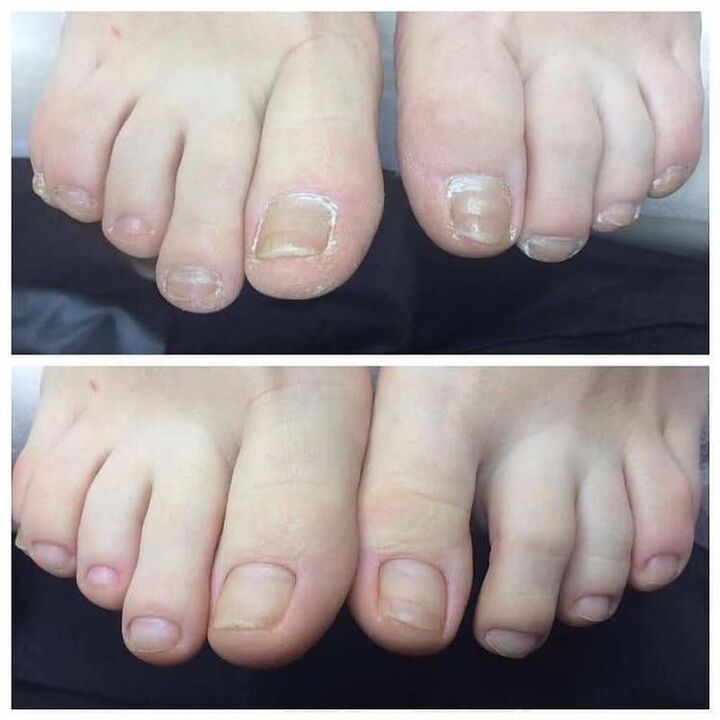 erabileraren berrikuspena Exodermin